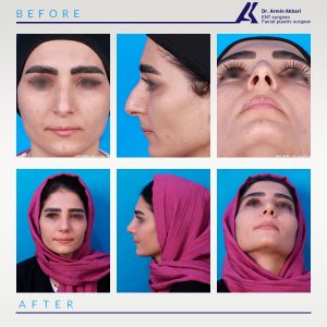 نمونه-کار-عمل-بینی-1