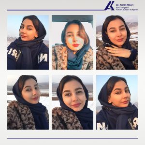نمونه-کار-عمل-بینی-17