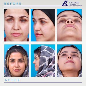 نمونه-کار-عمل-بینی-2