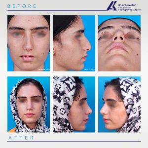 نمونه-کار-عمل-بینی-3