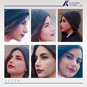 نمونه-کار-عمل-بینی-21