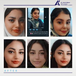 نمونه-کار-عمل-بینی-22