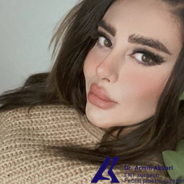 بهترین جراح بینی در سعادت آباد
