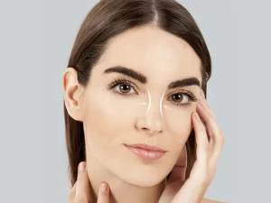 راهنمای کامل جراحی بینی