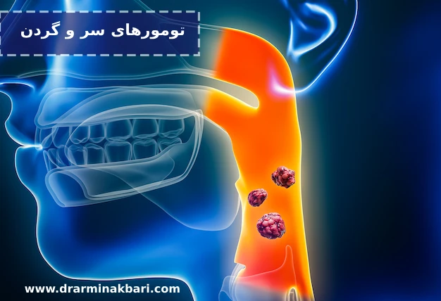 تومورهای سر و گردن