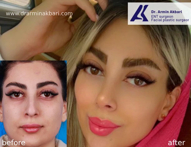 عمل-جراحی-بینی-فانتزی