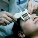 جراحی پلک در قزوین