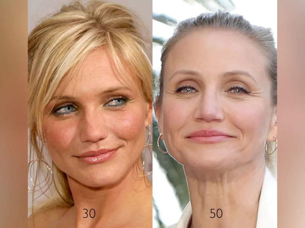 Cameron Diaz before after nose job