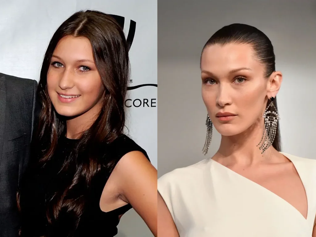 Bella Hadid before after nose job