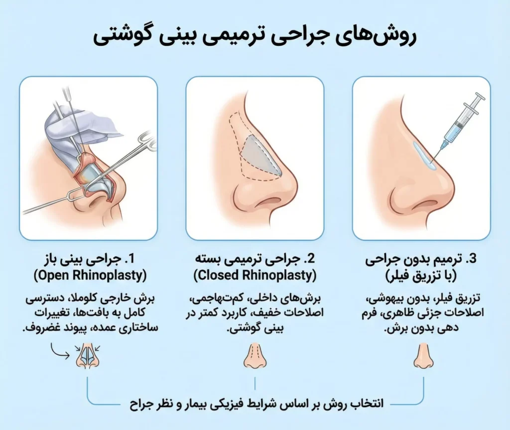 روش های جراحی ترمیم بینی گوشتی