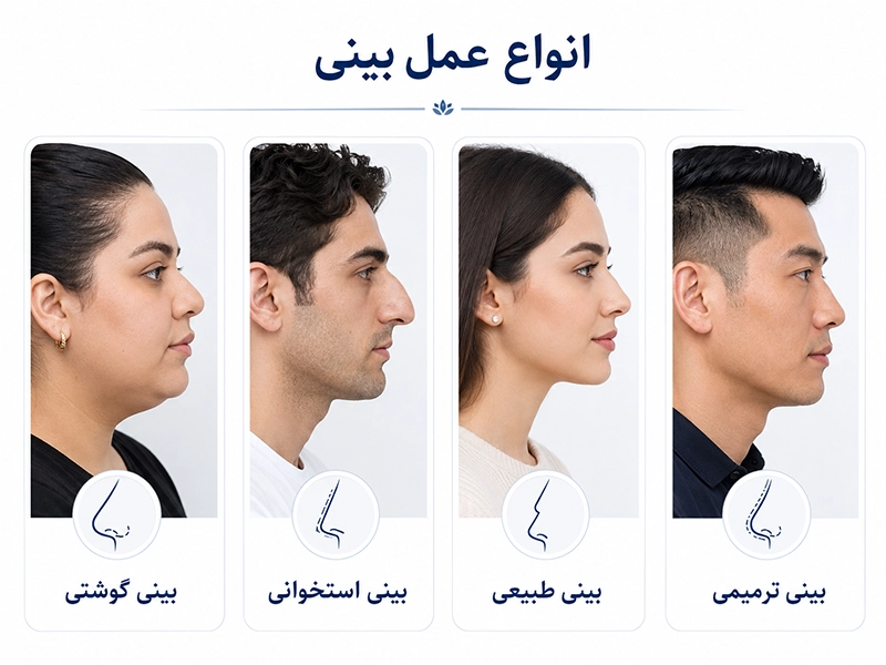 اینفوگرافیک انواع جراحی بینی شامل بینی گوشتی، استخوانی، طبیعی و ترمیمی